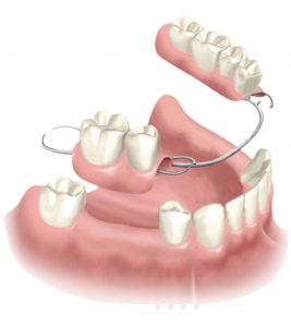 dentures periodontal liverpool